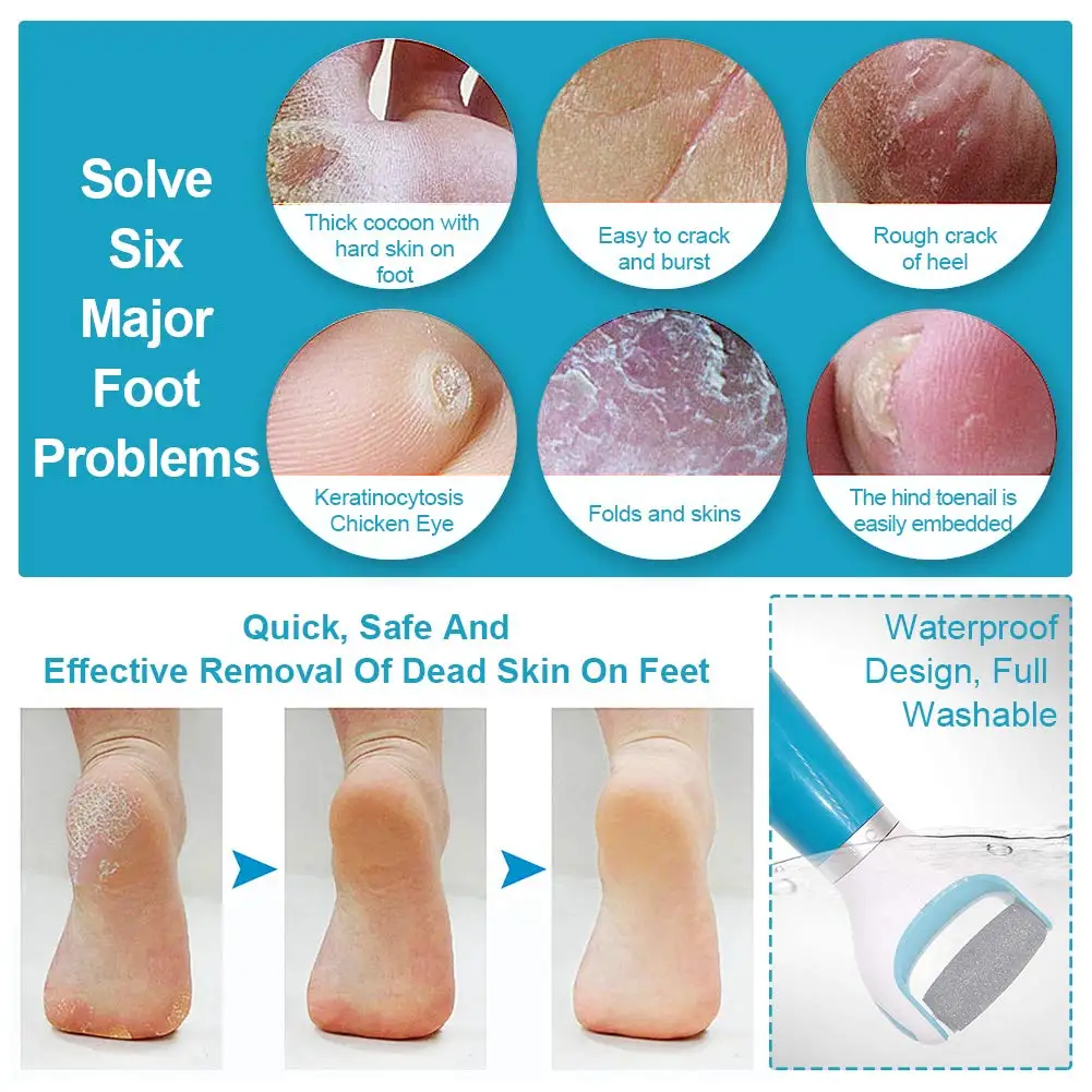 Buy Double Side Foot Skin Grinding Stone Dead Skin Remover Foot Callous  Removal Tool Foot Care Tool at affordable prices — free shipping, real  reviews with photos — Joom