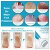 Electric Foot File Grinder Dead Skin Callus Remover for Foot Pedicure Tools Feet Care for Hard Cracked Foot Files Clean Tools bl 3