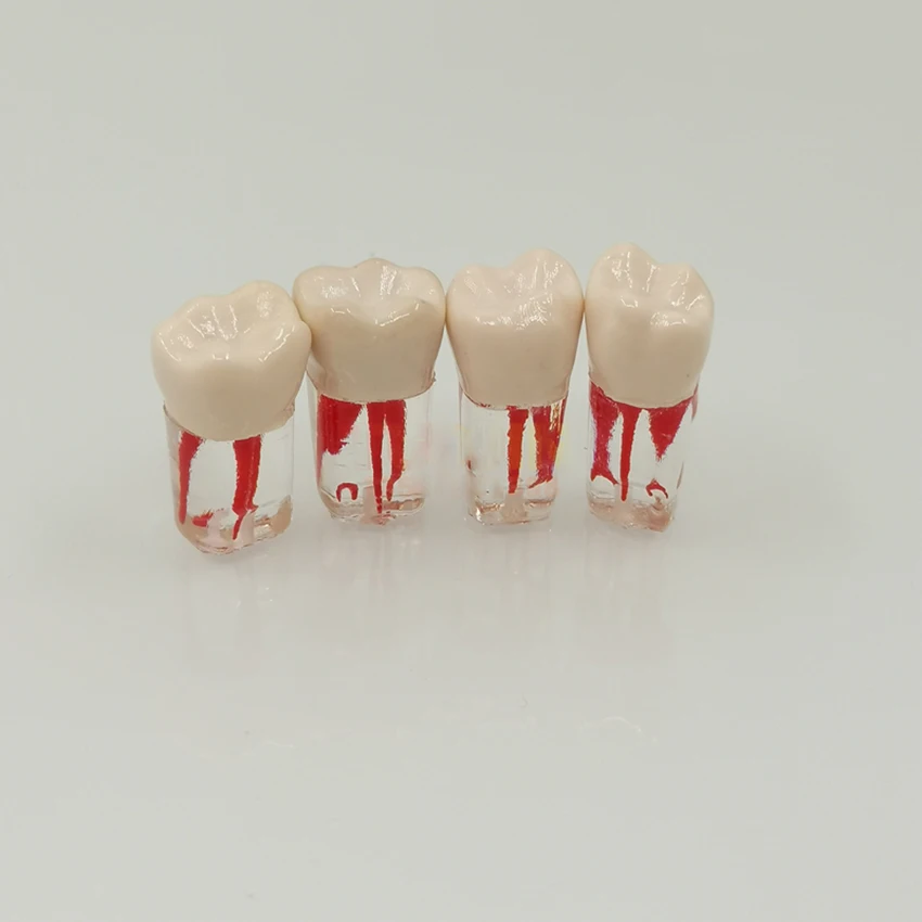 5pcs/set Dental Tooth Model Root Practice Pulp Cavity Clear Resin Teaching Teeth Model For Student Study Science Equipmenent
