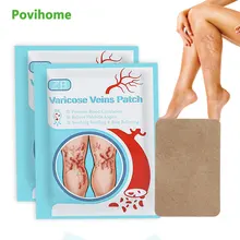 6/24/42pcs varicosas veias vasculite remendo aranha perna tratamento erva gesso médico chinês aliviar phlebite angiite adesivo