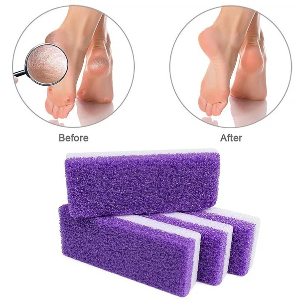 Foot Pumice Stone Sponge Block Callus Remover for Feet Hands Foot Scrub  Manicure Nail Tools Professional Pedicure Tools