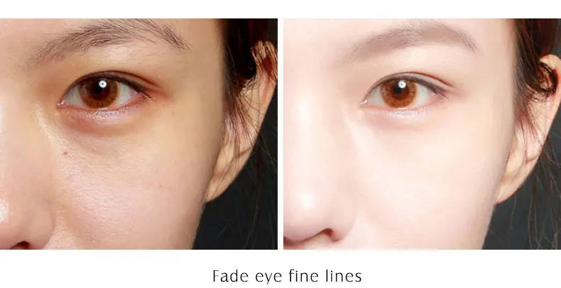 platinum-skin-care_15