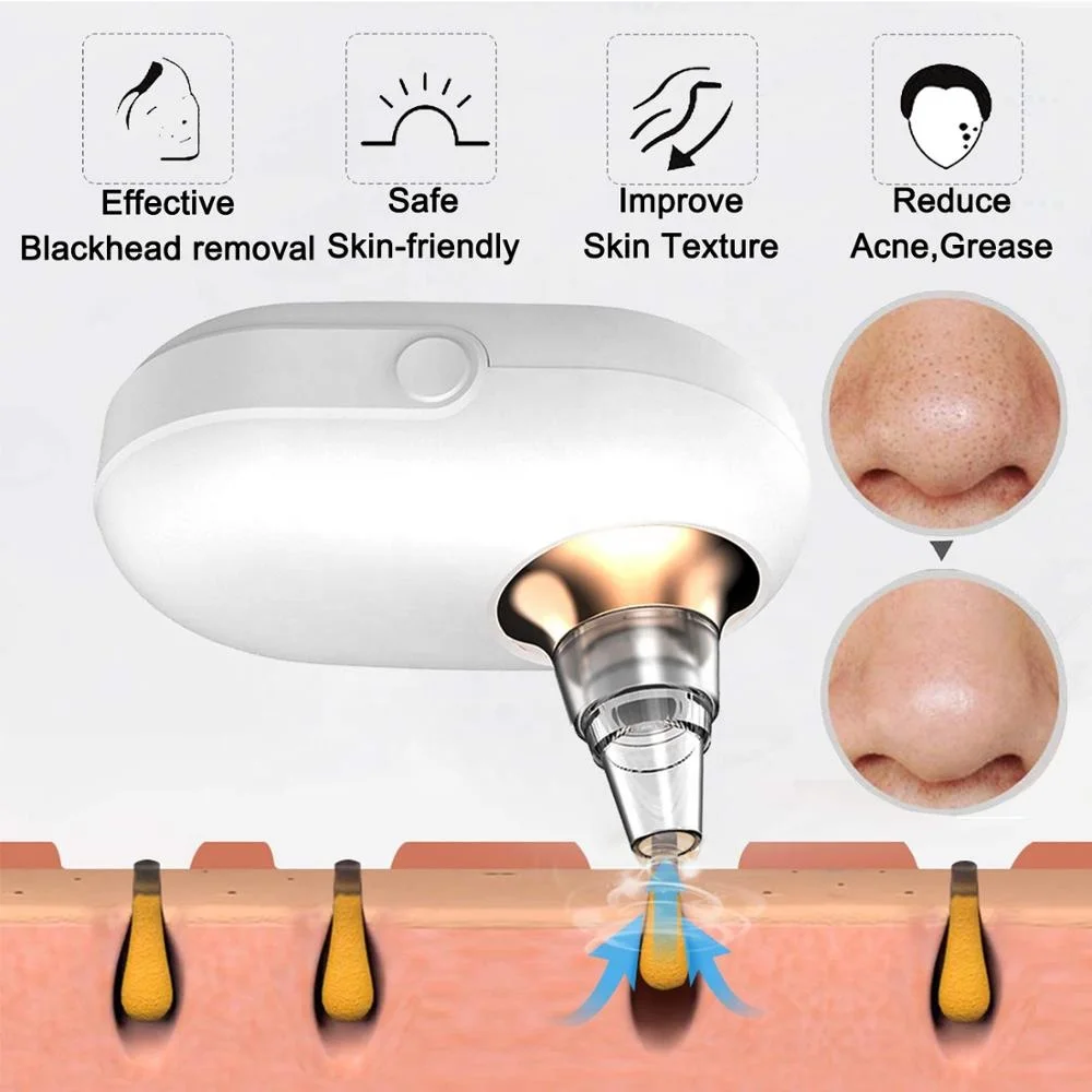 Blackhead Remover Acne Point Noir Vacuum Suction Extractor Tool Black Spots Pore Cleaner Facial Skin Care Tool Blackhead Remover Acne Point Noir Vacuum Suction Extractor Tool Black Spots Pore Cleaner Facial Skin Care Tool