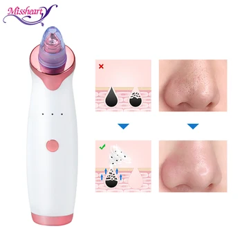 

Blackhead Vacuum Cleaner Pore Ance Black Dots Extractor Facial Cleansing Pimple Remover Tool Nose Acne Remover Machine For Face