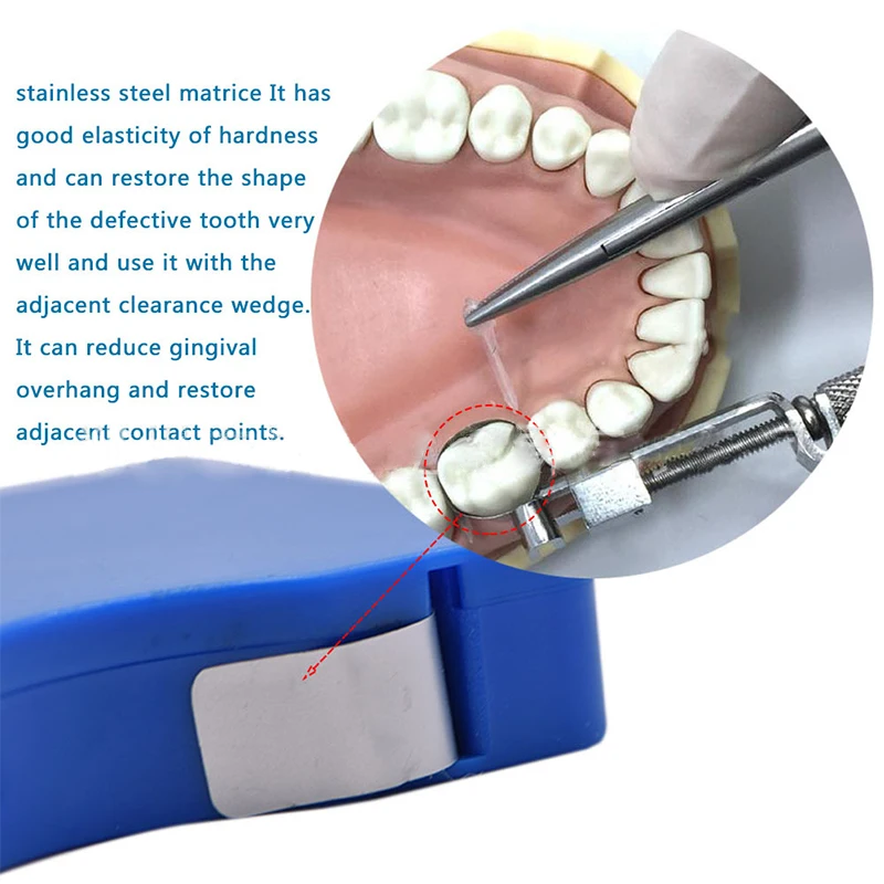 Dental Acciaio Inossidabile/Resina Matrice Matrix Bands Strip Roll Restauro Matrix Bands 5Mm/6Mm/7Mm Materiale Odontoiatrico