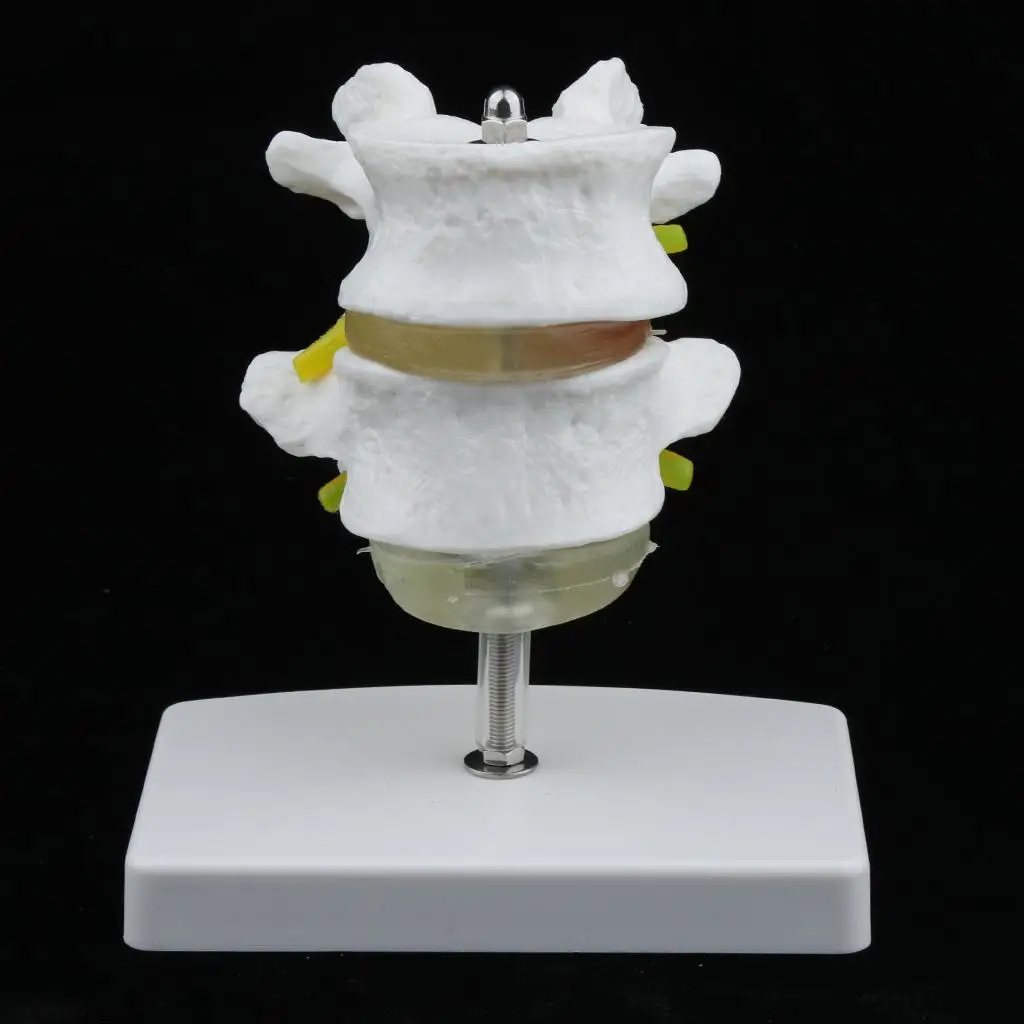 

2 Section Life Size Lumbar Vertebrae Model Medical Teaching Tool With Base