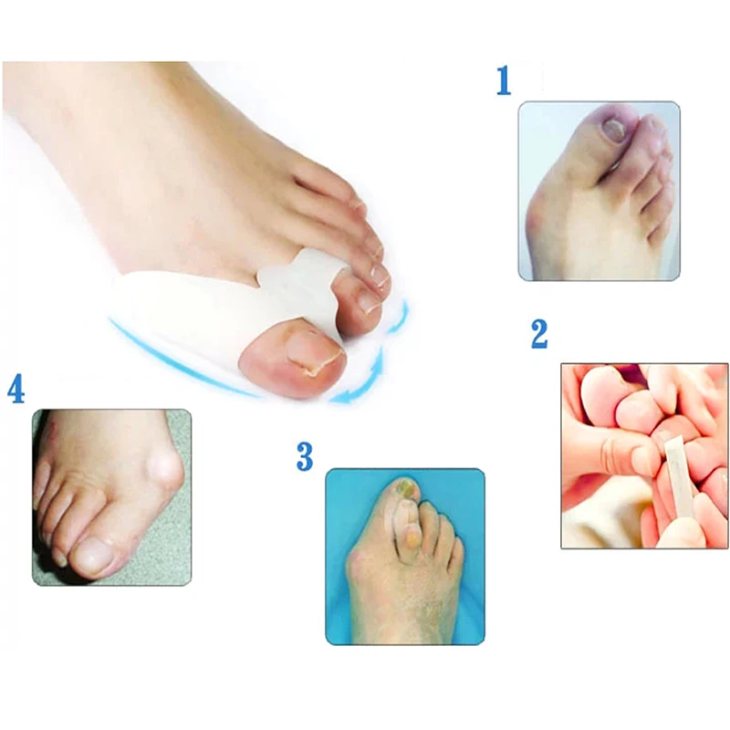 1Pair Gel Foot Care Tool Bunion Corrector Bone Big Toe Protector Hallux Valgus Straightener Toe Spreader Daily Big Bone Tools