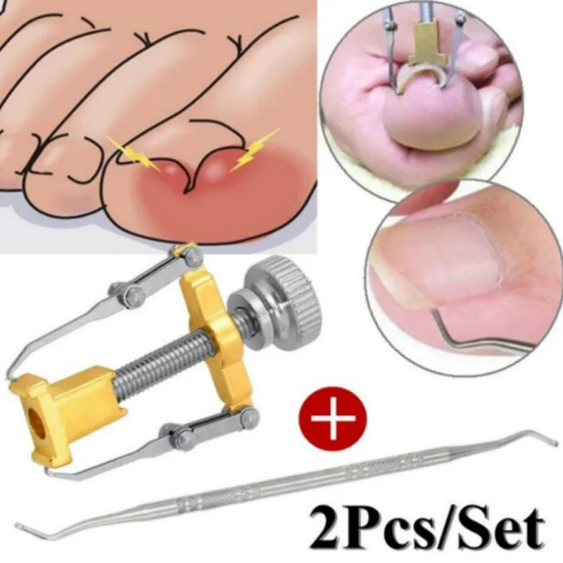 2/6pcs Set Cuticle Remover Kit Nail Clipper Trimmer for Cuticle Ingrown Nails Pedicure & Manicure Corrector Fixer Foot Care Tool