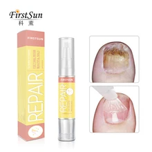 Профессиональный 4 мл Лечение ногтей от грибка ноги Дезинфекция Рук ногтей грибковое лечение масло ручка Маникюр Инструменты для лечения