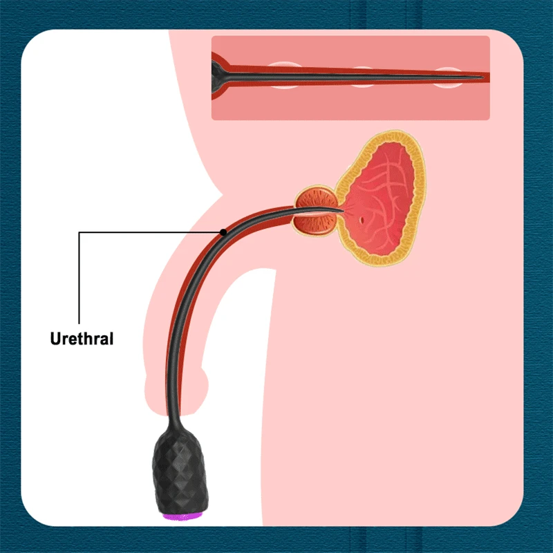 Men'S Masturbator Vibrator Urethral Plug Extender Intimate Toys For Men Penis Plug Urethral Dilator Stimulation Stopper Nds