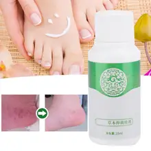 Духи для тела 35 мл травяные анти-грибки анти зуд антибактериальный дезодорант Уход за ногами спрей ноги жидкие духи для тела