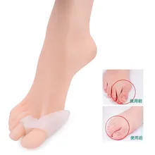 Импортный силиконовый защитный рукав вальгусная деформация большого пальца черные ножные талипы вальгусная деформация коррекция носка