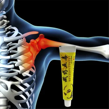 

New Chinese herbal medicine Ointment Balm Plaste For Rheumatoid arthritis Cervical spondylosis Bruises Sprains Lumbar and leg pa