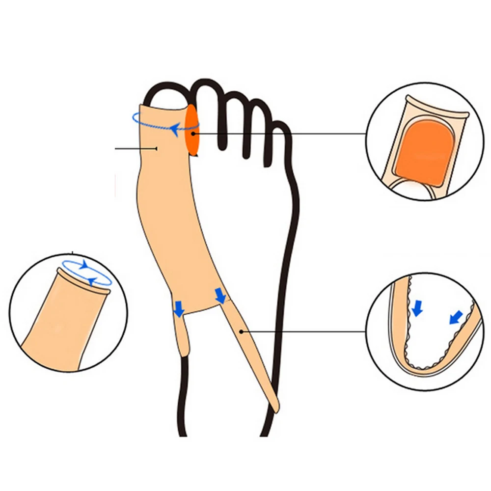 Корректор для большого пальца стопы можно устройство, корректор исправление вальгусной деформации первого пальца стопы ортопедической брекеты большой коррекция носка ноги с накатанной головкой уход корректор Ортопедия большой кости