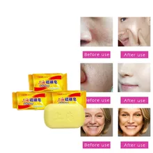 Здоровое яркое мыло для кожи Шанхая традиционное серное китайское лекарственное мыло для удаления акаридов, стерилизовать устраняет воспаление