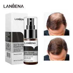 LANBENA Hair Growth Essence Spray Product Preventing Baldness Consolidating Anti Hair Loss Nourish Roots Hair Care Dropshipping
