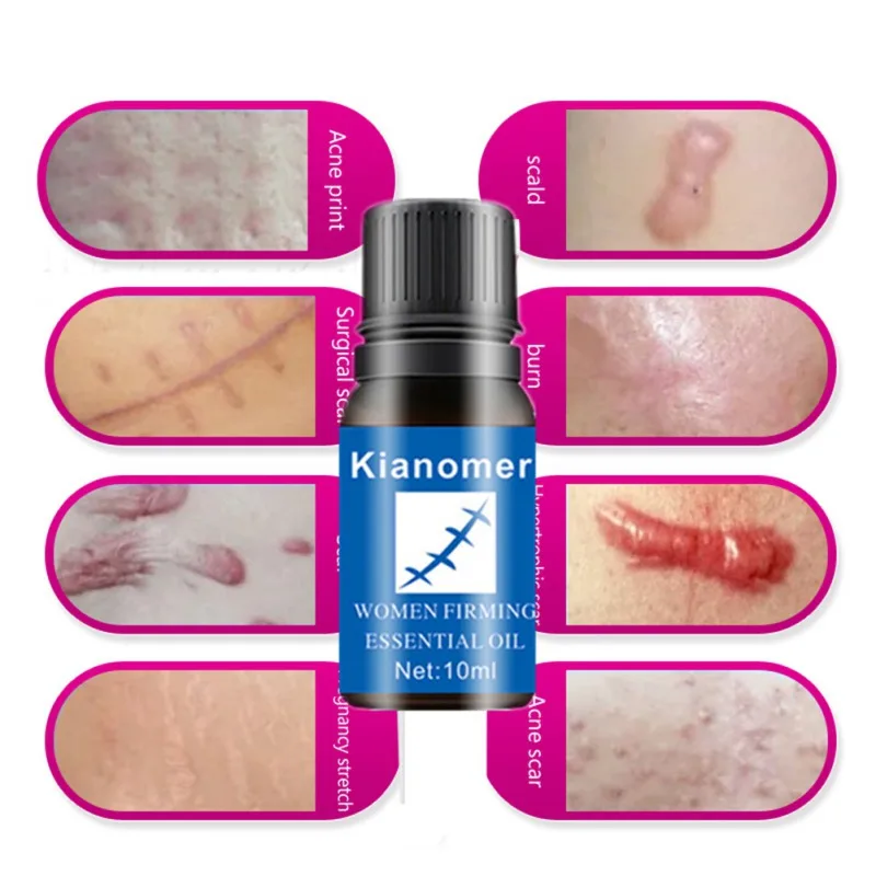 10ml Scars Removal Oil Nourishing Skin Lightening Pigment Acne Marks Scars Remover