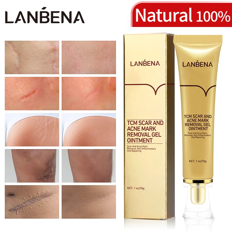 lanbena brand origin