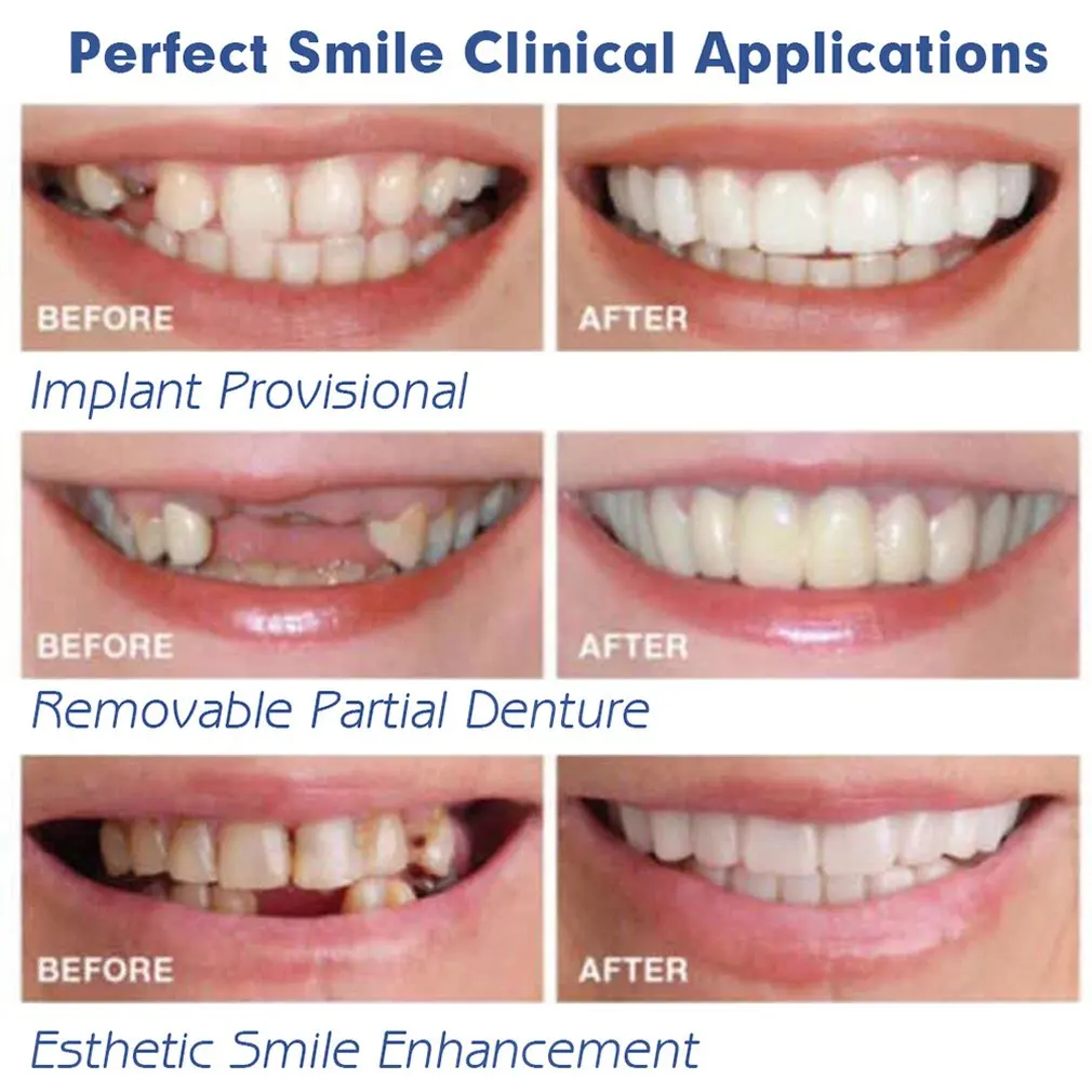 Имитация отбеливания зубов рукав силиконовый зубной протез Верхняя Нижняя часть