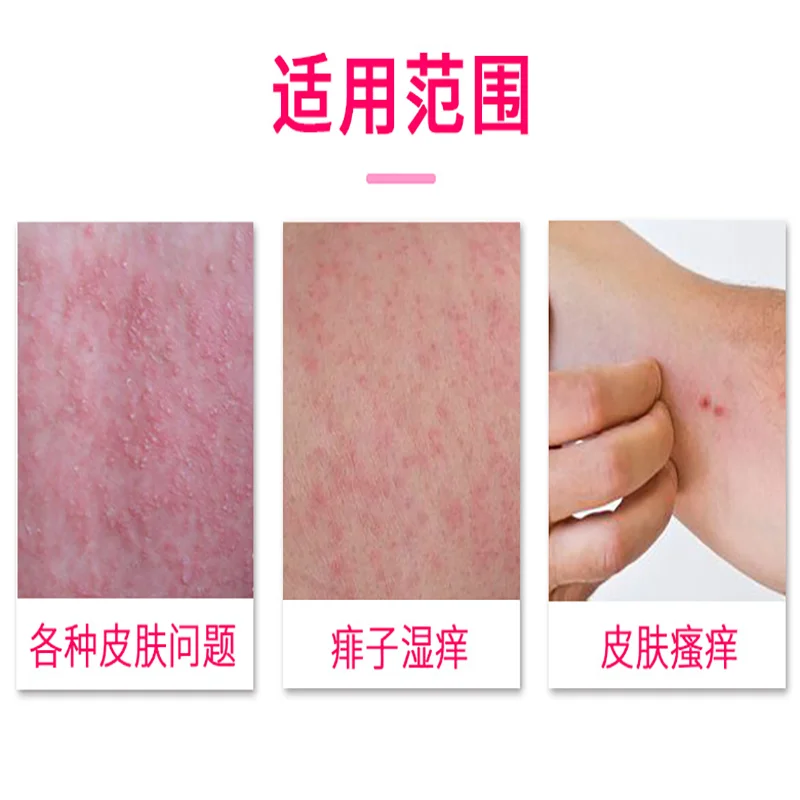 Gaitianling Skin Cleansing Itchy Skin Sterilization Calamine Antibacterial Lotion 100ml