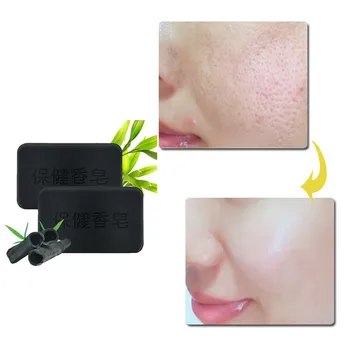

Lightening And Moisturizing AntiAging Herbal 40g Soap for Body Face Plant Tourmaline AntiAcne And Antiallergic Anti-wrinkle