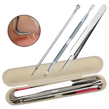 Нержавеющая сталь Pro черных точек пятен комедонов акне Элиминатор съемной скрепкой Красота набор инструментов