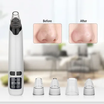 

Blackhead Remover Vacuum USB Facial Pore Cleanser Tools with 4 Suction Heads and Hot Compress Function for Face Skin Care