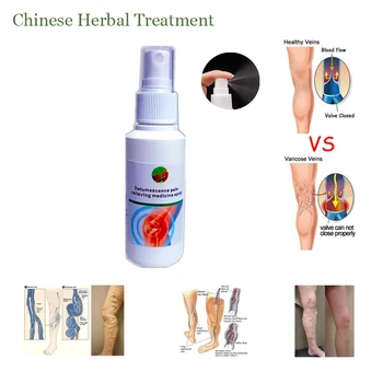 

New Medical Joint Pain Care Essential Oil Notopterygium Root Arthralgia Frozen Shoulder Massage Oil Exercise Injury Spray 85ml