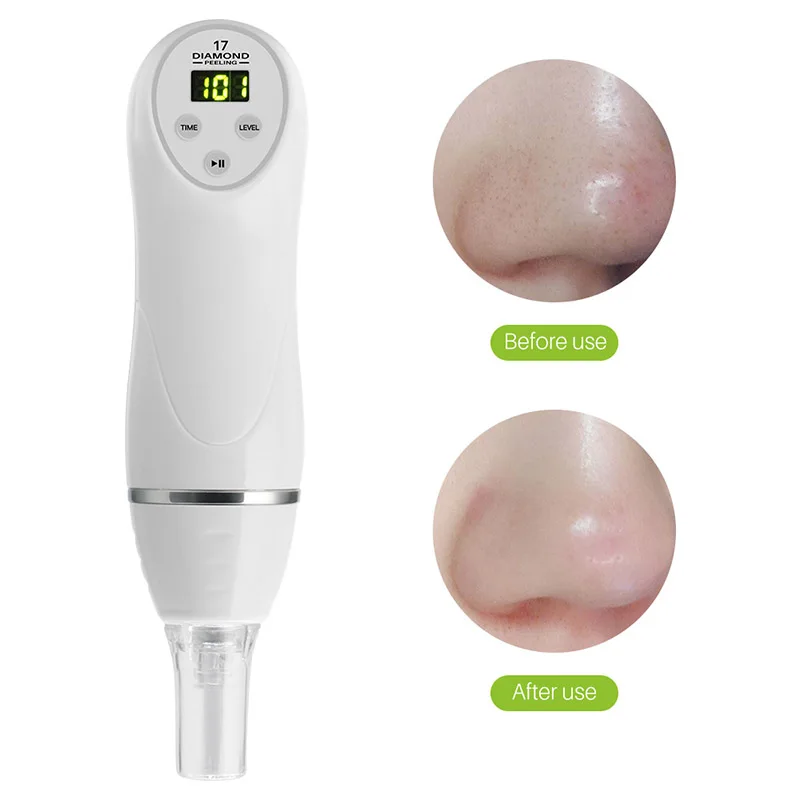 

Vacuum Cleaner Blackhead Remover Face Ance Dissolving Blackheads Blackheads Vacuum Cleaner Pores Cleanser Skin Care Tools