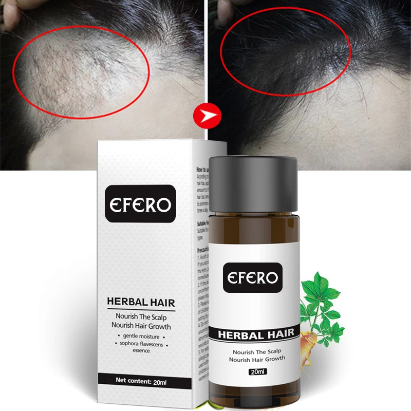 

20ml Unisex Hair Growth Essence Oil Hair Loss Dense Hair Fast Growth Grow Restoration Growing Serum Hair Care Wholesale TSLM1