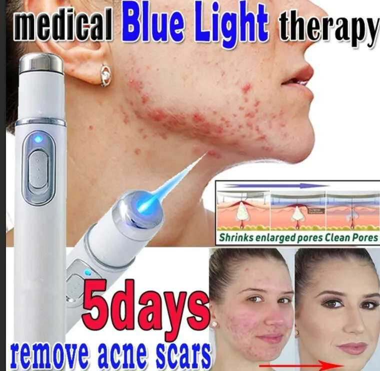 Медицинский синий светильник, терапия варикозного расширения вениса, лечение акне, лазерная плазменная ручка, крем для удаления шрамов, ручка для массажа, ластик в виде паука