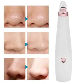 

Electric Pore Cleaner Household cne Blackhead Removal Suction Instrument Face Pore Acne Cleaner Removal Machine