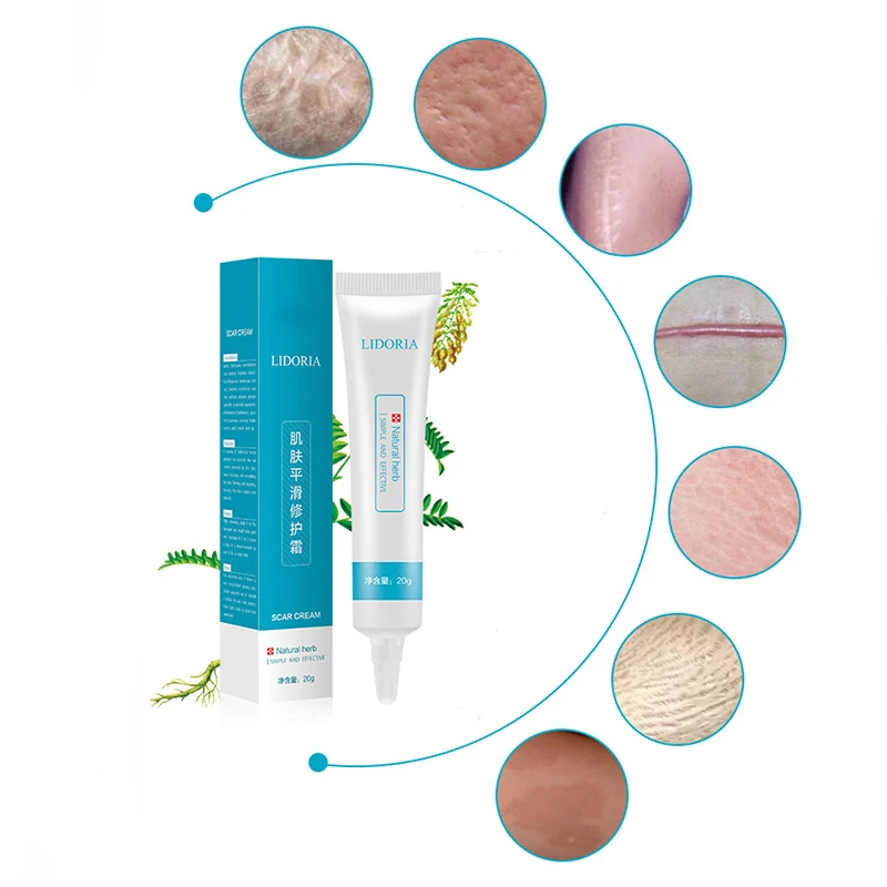 lidoria acne cream