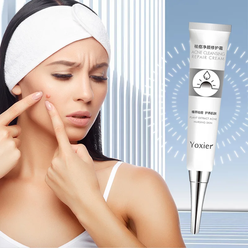 Yoxier Moisturizing Acne Treatment Face Cream Anti Scar Removal Pimple Blackhead Whiten Oil-control Shrink Pores Skin Care | Красота и