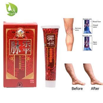 

5 packs Cure Spider Varicose Veins ointment Varicose Treatment Plaster Varicose Veins Cure Patch Vasculitis Natural Solution