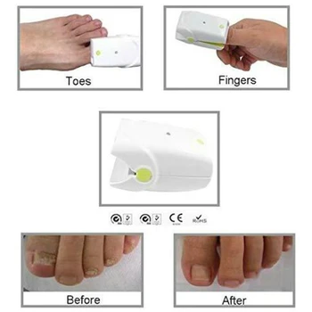

905nm 470nm Lllt Cold Laser Therapy Device Soft Laser Therapy Device For Finger Nails Fungus Treatment Toe Nails Fungus Removal
