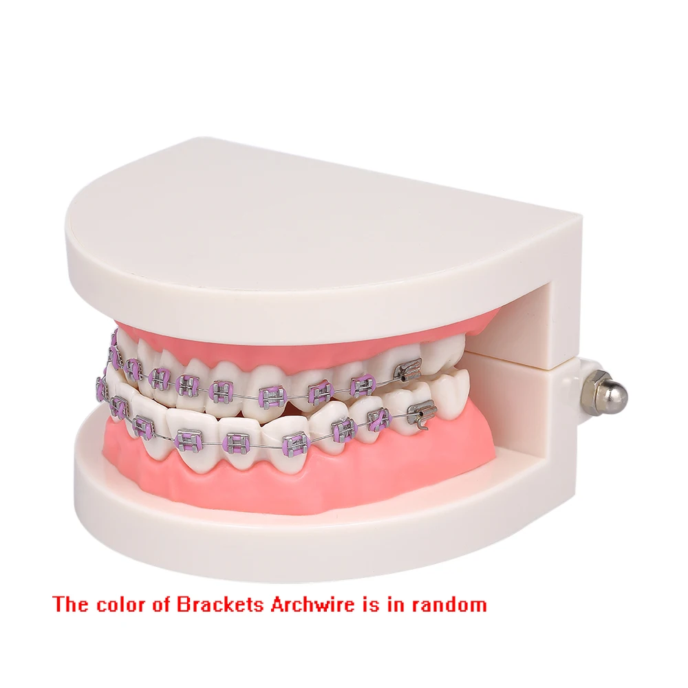 Dental Orthodontic Mallocclusion Model with Brackets Archwire Buccal Tube Teeth Model for Patient Communication Adult Teaching