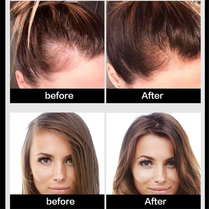H321c69498b9d4eeea291c4c4ce5b19eb0 Beauty-Health 30/20/10 ML Effective Hair Growth Serum