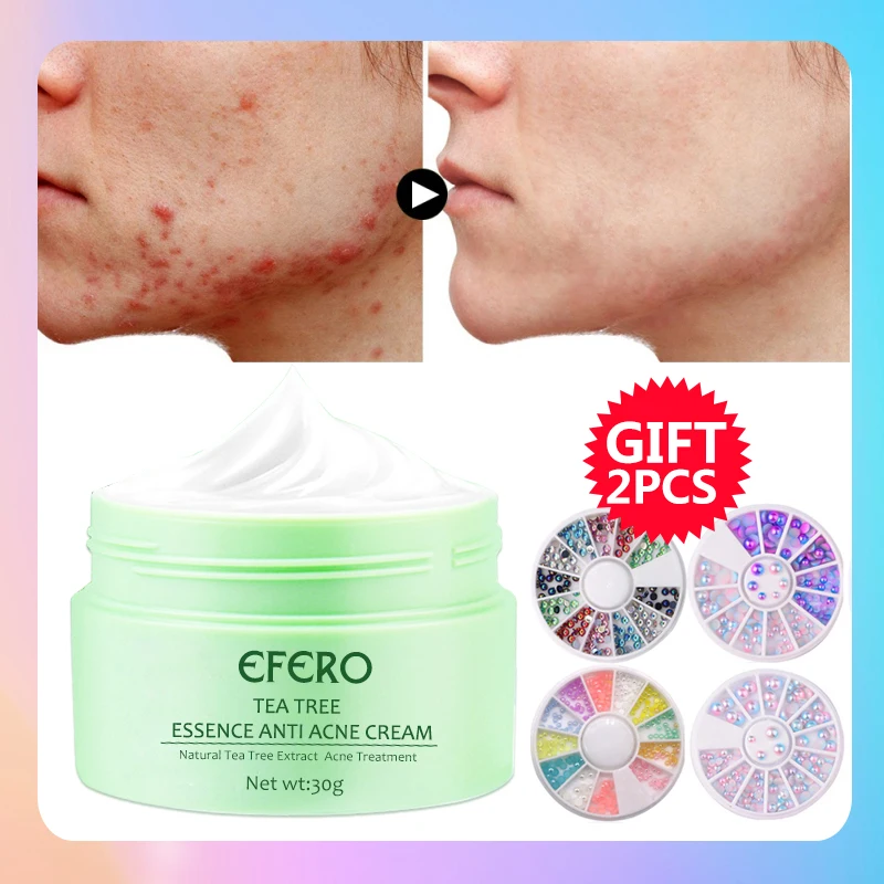 

efero Anti Acne Cream Tea Tree Essence Face Cream Oil Control Shrink Pores Acne Cream Nourish Skin Whitening Acne Scar Removal