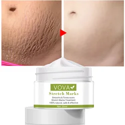 VOVA Stretch Marks Repair Cream Fades Fine Lines Remove Pregnancy Skin Tear Repair Scar Whitening Moisturizing Firm Body Cream