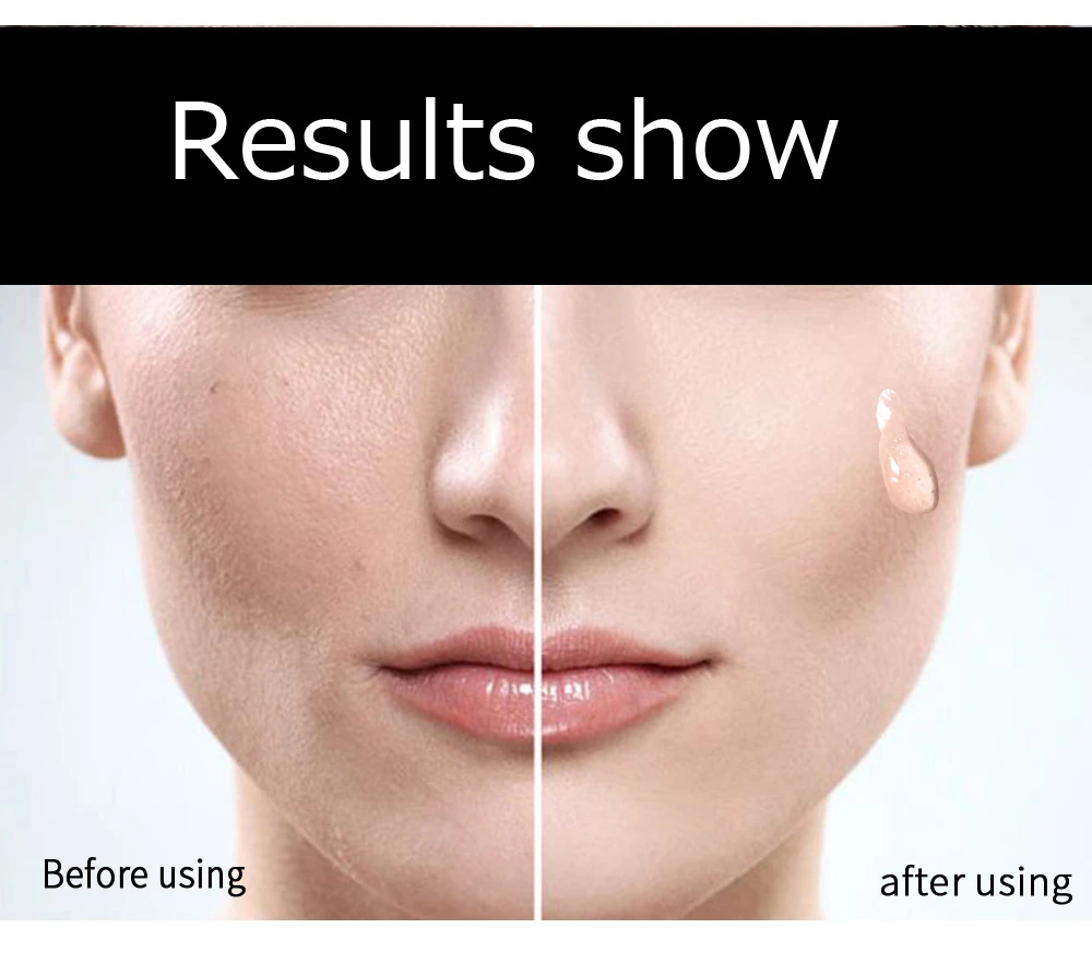 niacinamide for dark spots