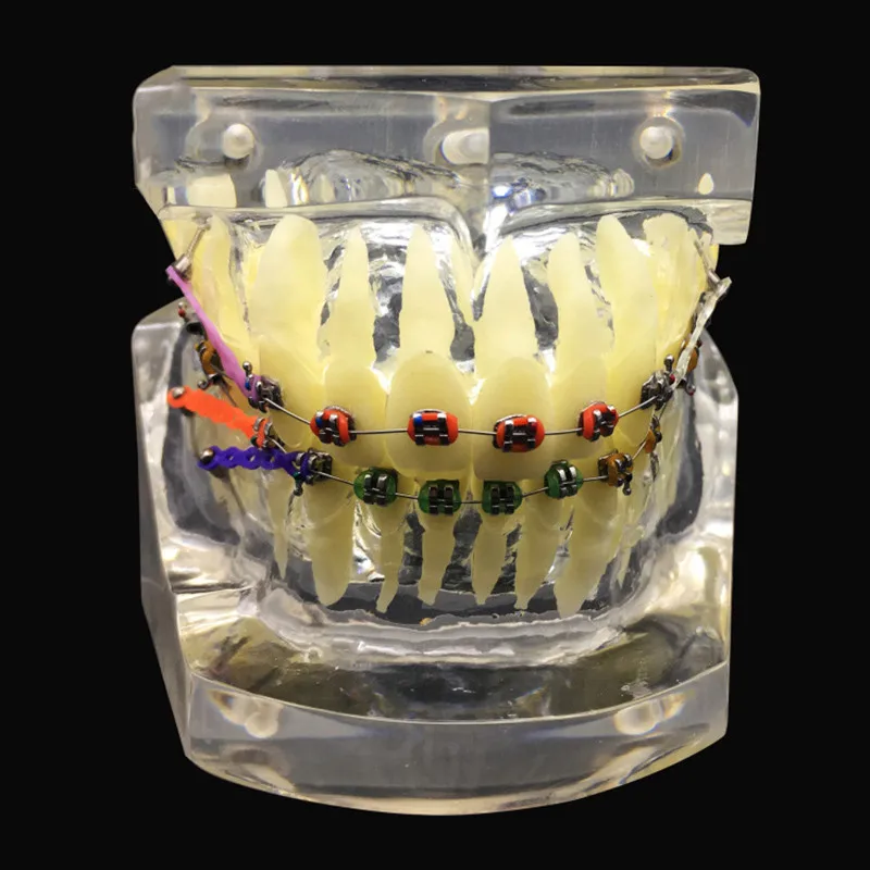 Стоматологическая стандартная Ортодонтическая модель прозрачная коррекция зубов дисплей модели с кронштейном лигатурная проволока Стоматологическая модель зубов