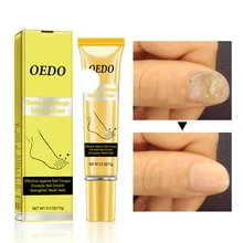 Уход за ногтями крем для удаления онихомикоза грибка пароникья способствует росту ногтей Крем для ног Уход за ногтями