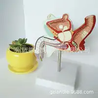 1:1 Life Size Human Male Internal Reproductive Pathology Lesion Anatomical Urinary System  Medical  Disease Model