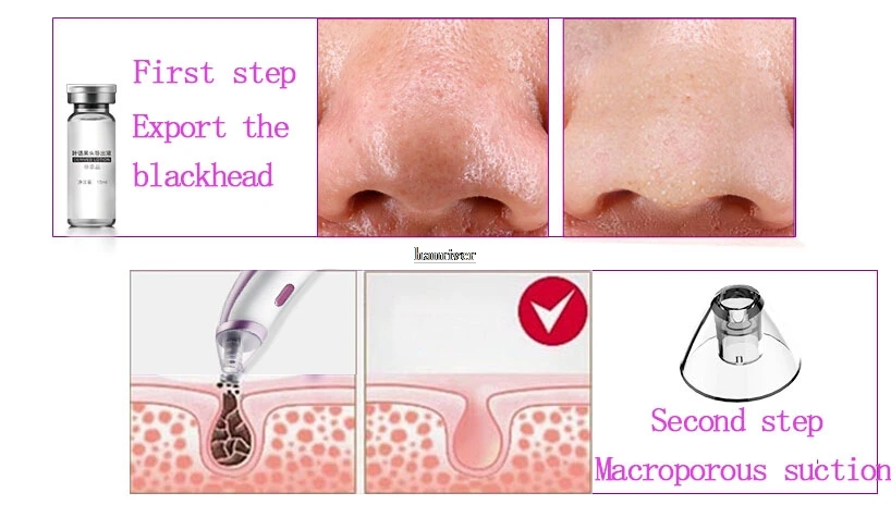 HTB1xNHLQpXXXXXOXFXXq6xXFXXXG