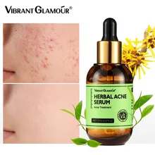 VIBRANT GLAMOUR Herbal Acne Treatment Serum Oil Control Brighten Nourish Whitening Shrink Pores Remove Scars Marks Skin Care17ml
