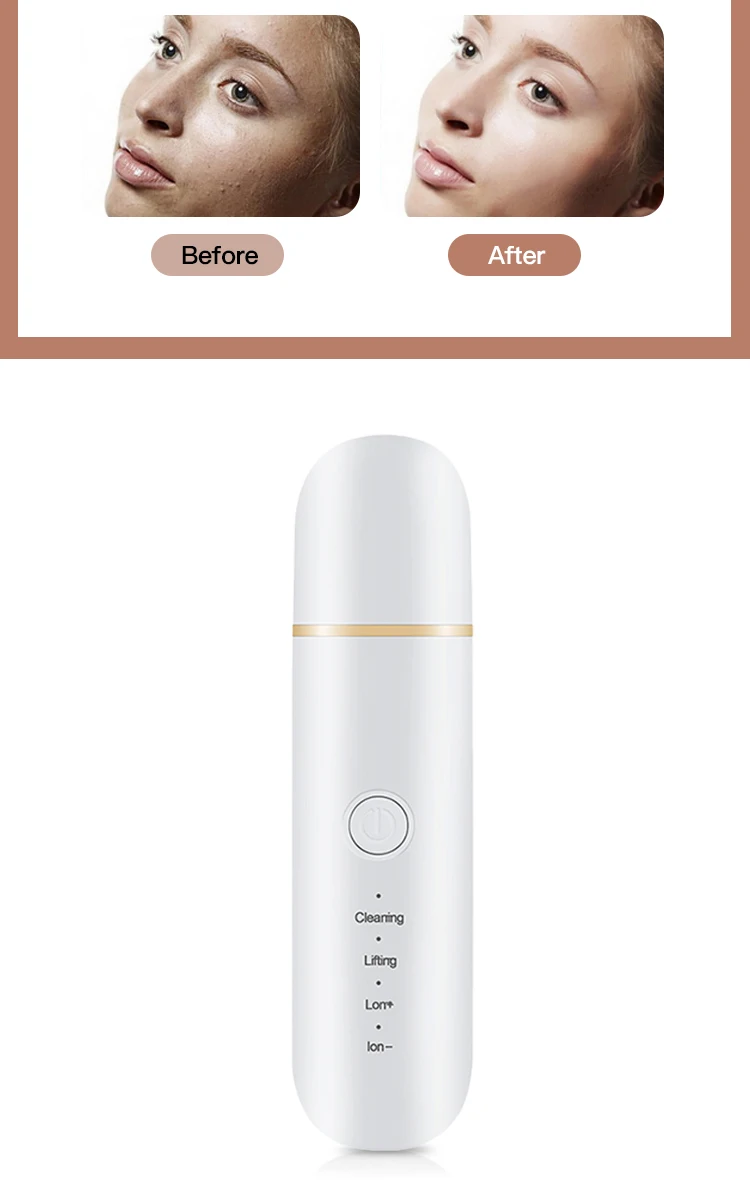Purificador Facial Ultrassônico de Pele Limpeza Profunda Peeling Facial Espátula de Descamahomemto Beleza Esfoliante Cuidados com a Pele Limpeza do Rosto 16 cuidados com a pele, limpeza do rosto