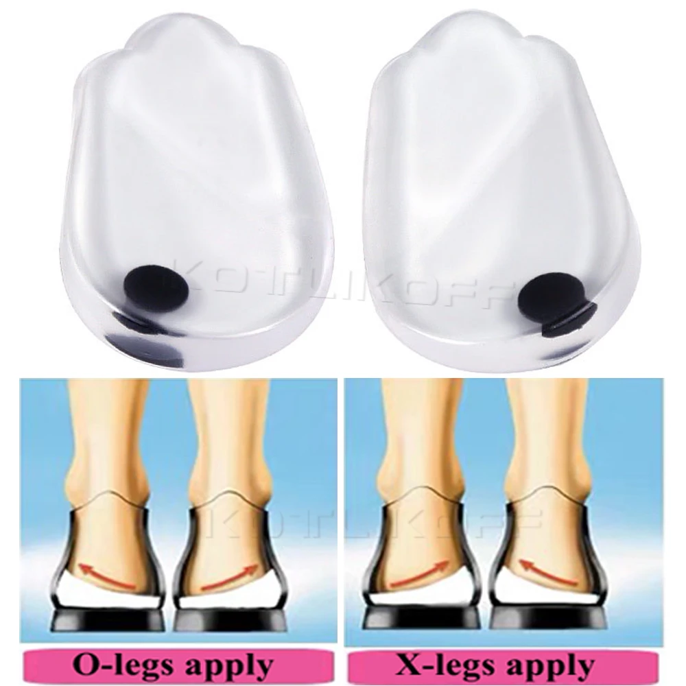 Shoe Insoles Magnetic Massage Gel O/X Type Leg Orthotics Heel Pads Corrective Valgus Varus Foot Insert Pads