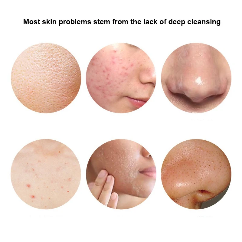 Removal Pimple Pore Acne Treatment Sea Salt Soap Cleaner Moisturizing Oil-Control Goat Milk Soap Face Care Wash Basis Soaps100g