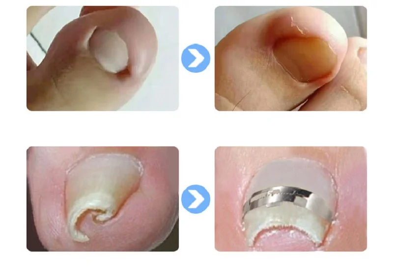 12260491873_402575362